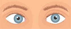 انحراف العين الداخلي (الإيزوتروبيا)