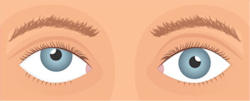 Upward Deviation of the Eye (Hypertropia)