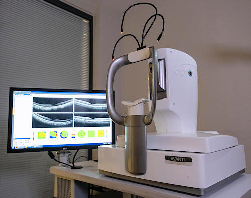 Оптическая когерентная томография (OCT)